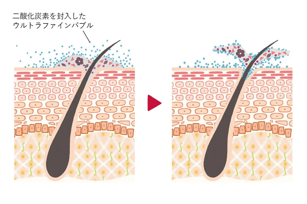 二酸化炭素を封入したウルトラファインバブル
